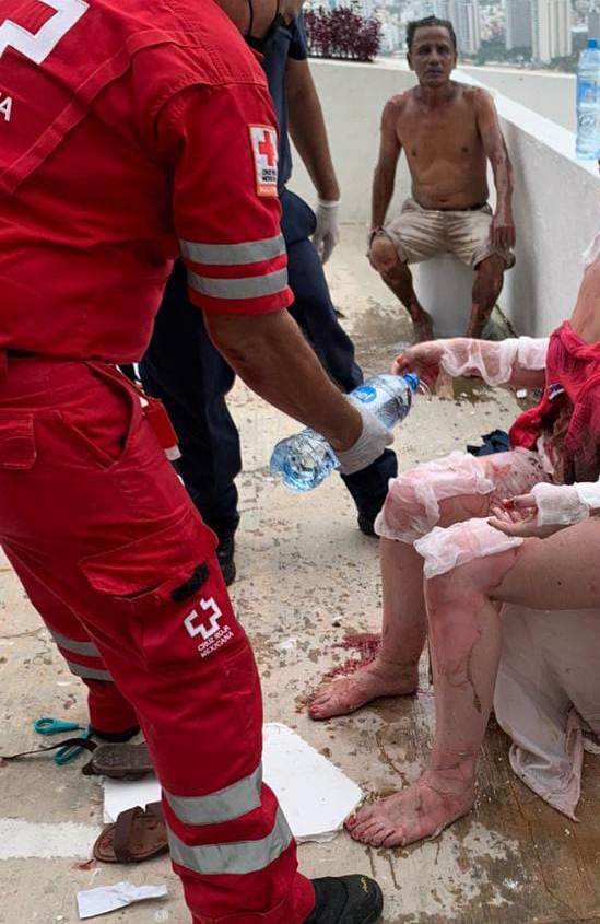 En Acapulco… Explosión en Brisas Diamante deja 8 lesionados con quemaduras de segundo y tercer grado