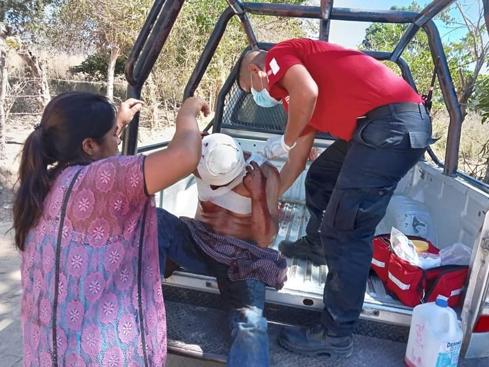 Hieren a machetazos a un hombre en Zacualpan, Ometepec; está grave