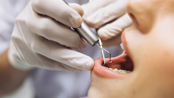 Mil pacientes se atienden mensualmente en Zihuatanejo por enfermedades dentales