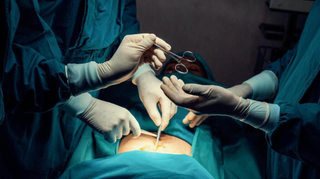 Joven muere tras lipoescultura en Jalisco; ‘El Kevin’ presunto cirujano, escapó por el tragaluz