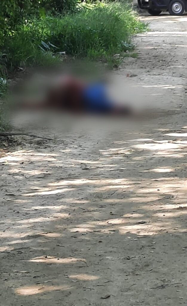 En Acapulco… Muere un hombre en el hospital tras ser atacado a balazos en San Agustín