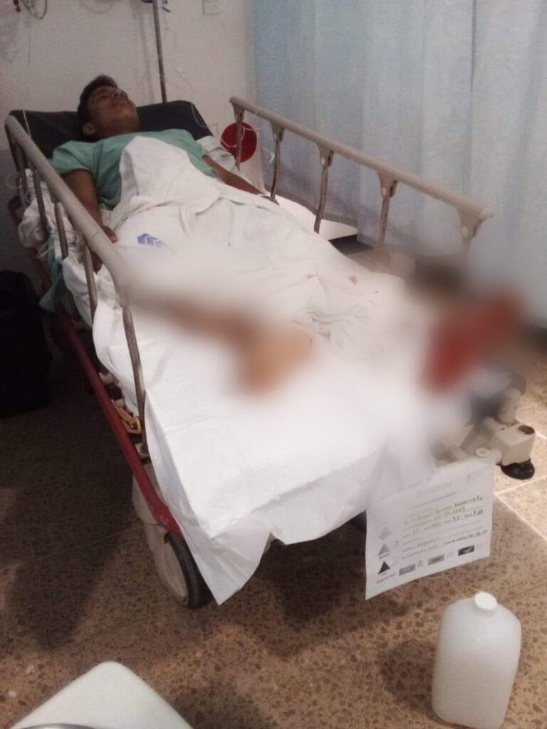 Piden ayuda para un joven que se accidentó y quebró la pierna Atoyac
